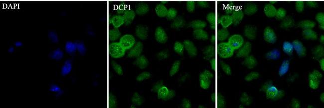 EDC4 Antibody in Immunocytochemistry (ICC/IF)