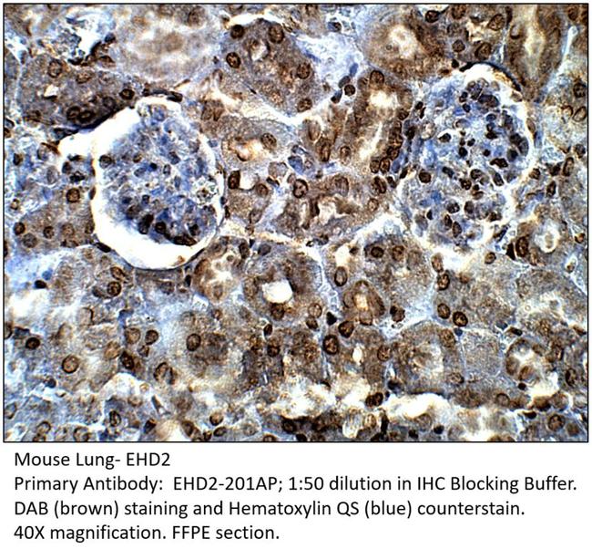 EHD2 Antibody in Immunohistochemistry (IHC)