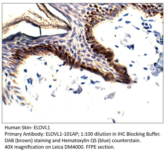 ELOVL1 Antibody in Immunohistochemistry (IHC)