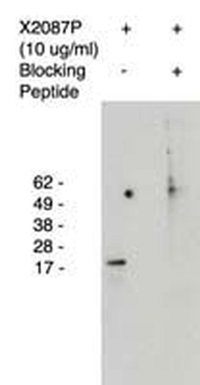 ELOVL4 Antibody in Western Blot (WB)