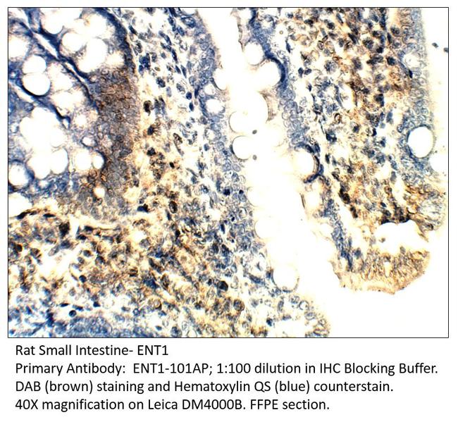 ENT1 Antibody in Immunohistochemistry (IHC)