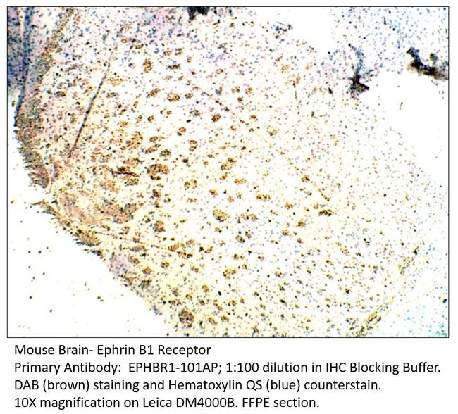 Ephrin Receptor B1 Antibody in Immunohistochemistry (IHC)