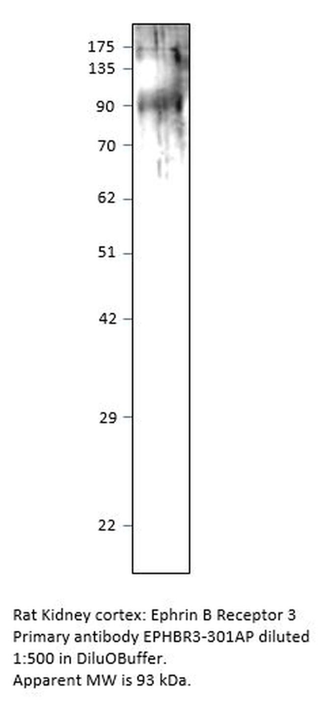 Ephrin Receptor B3 Antibody in Western Blot (WB)