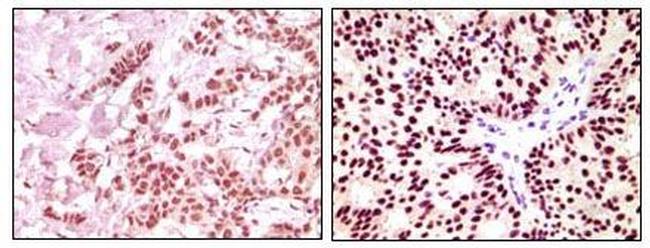 Estrogen Receptor alpha Antibody in Immunohistochemistry (Paraffin) (IHC (P))