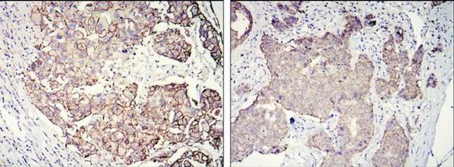 ErbB2 (HER-2) Antibody in Immunohistochemistry (Paraffin) (IHC (P))