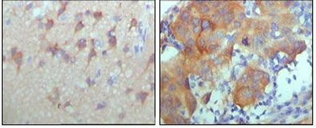 ErbB3 Antibody in Immunohistochemistry (Paraffin) (IHC (P))