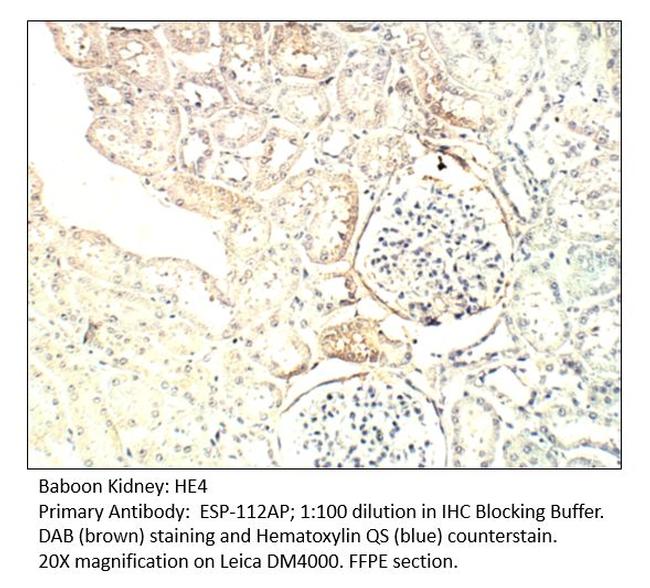 HE4 Antibody in Immunohistochemistry (IHC)