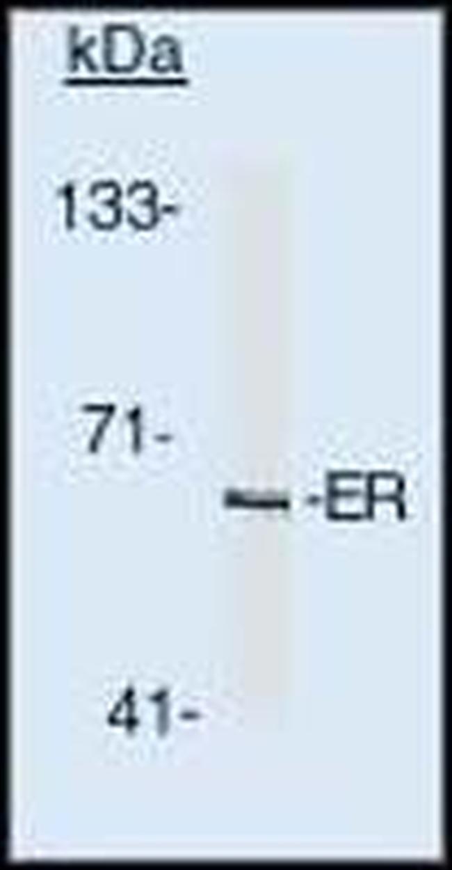 Estrogen Receptor alpha Antibody in Western Blot (WB)