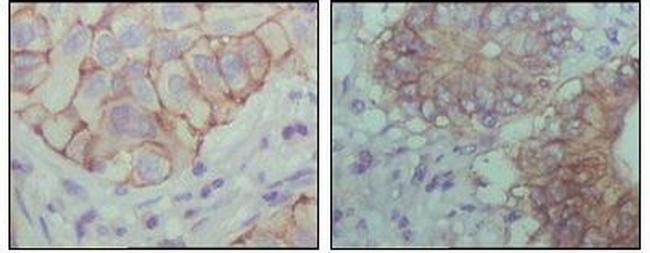 EphB1 Antibody in Immunohistochemistry (Paraffin) (IHC (P))