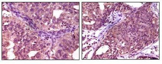 EphA1 Antibody in Immunohistochemistry (Paraffin) (IHC (P))