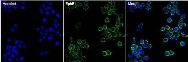 EphB4 Antibody in Immunocytochemistry (ICC/IF)