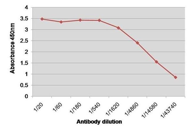 Factor VIII Antibody in ELISA (ELISA)