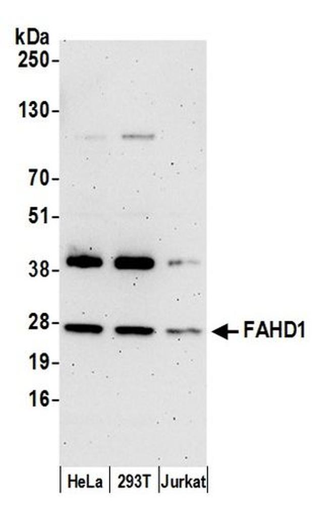 FAHD1 Antibody in Western Blot (WB)