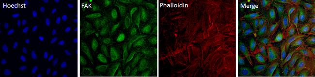 FAK Antibody in Immunocytochemistry (ICC/IF)