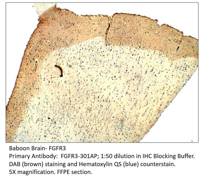 FGFR3 Antibody in Immunohistochemistry (IHC)