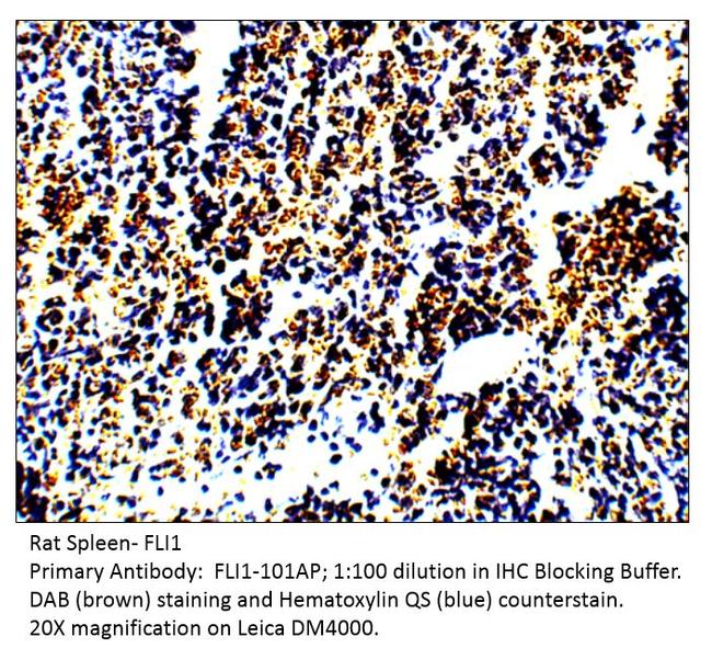 FLI1 Antibody in Immunohistochemistry (IHC)