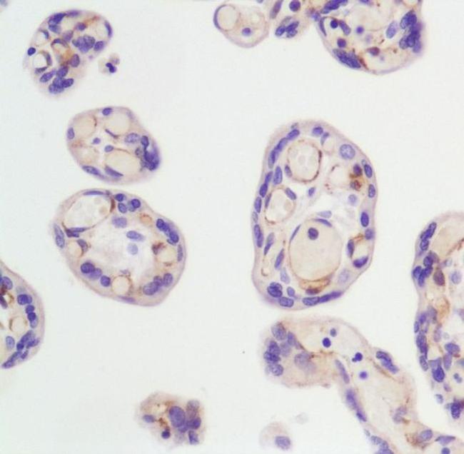 VEGF Receptor 2 Antibody in Immunohistochemistry (Paraffin) (IHC (P))