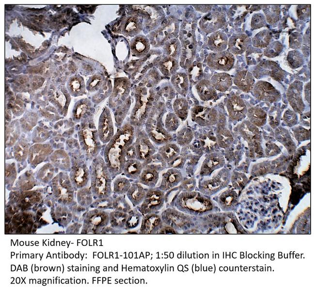 FOLR1 Antibody in Immunohistochemistry (IHC)