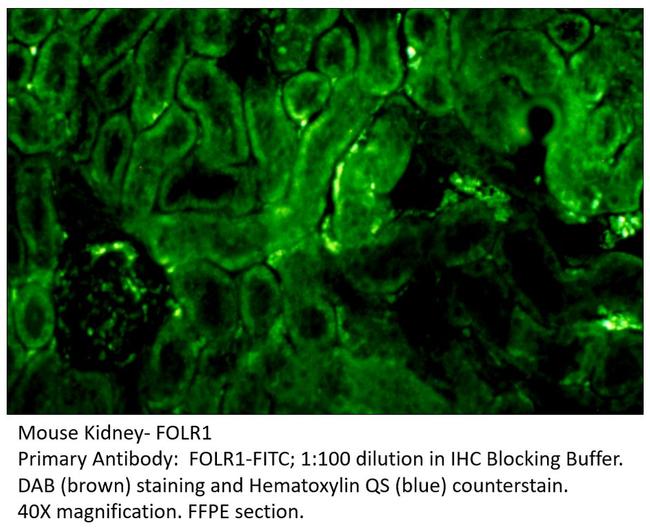 FOLR1 Antibody in Immunohistochemistry (IHC)