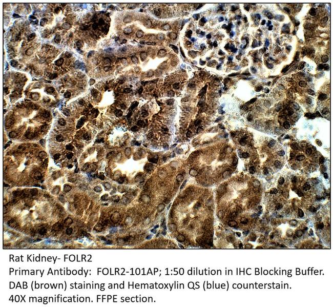 FOLR2 Antibody in Immunohistochemistry (IHC)