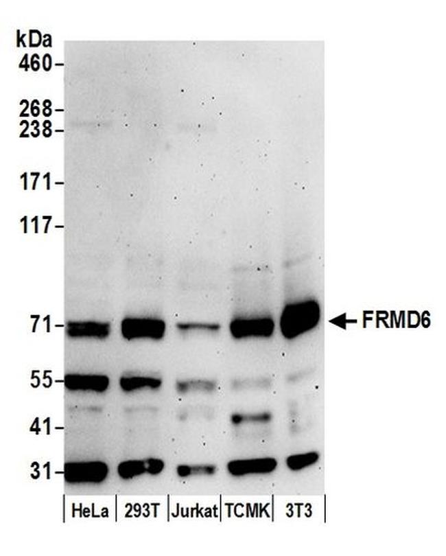 FRMD6 Antibody in Western Blot (WB)