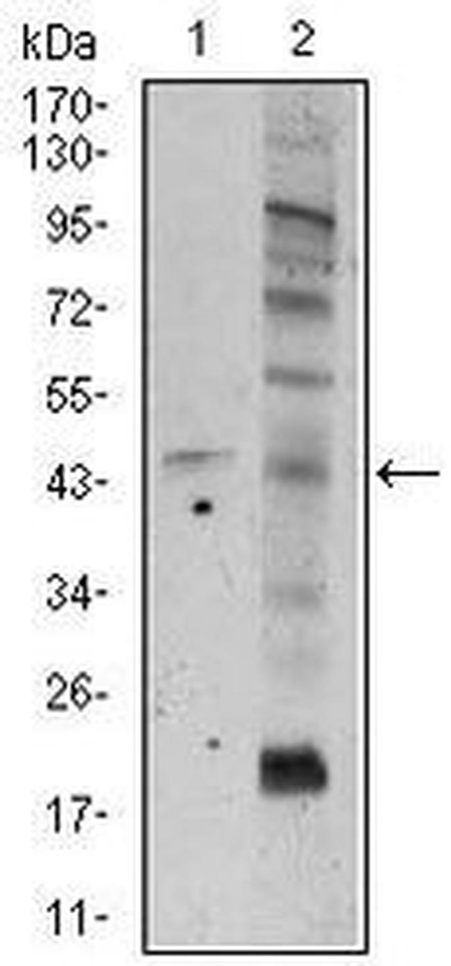 FZD5 Antibody in Western Blot (WB)