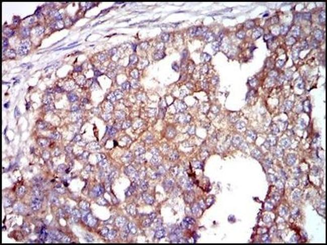 G6PD Antibody in Immunohistochemistry (Paraffin) (IHC (P))