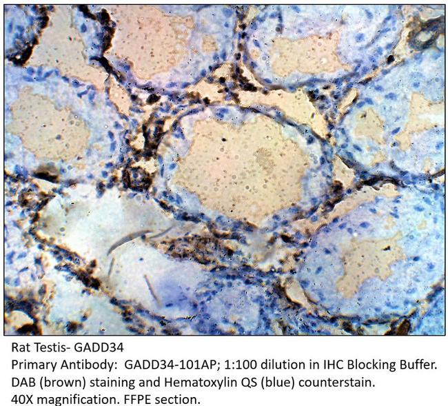 GADD34 Antibody in Immunohistochemistry (IHC)