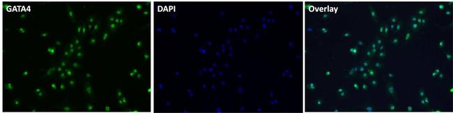 GATA4 Antibody in Immunocytochemistry (ICC/IF)