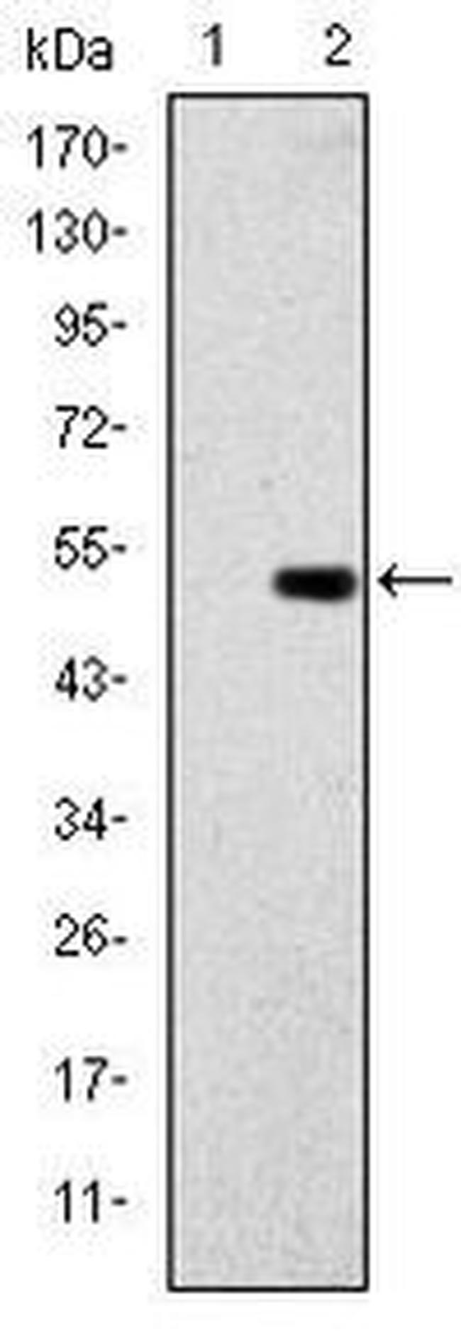 GCK Antibody in Western Blot (WB)