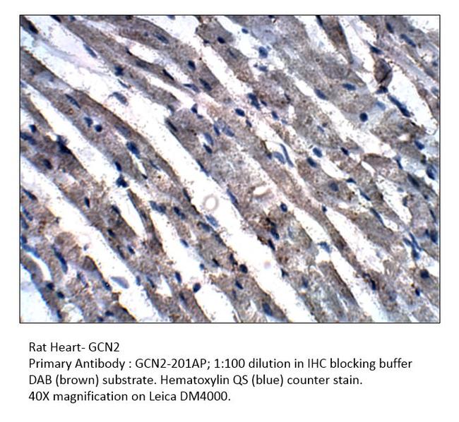 GCN2 Antibody in Immunohistochemistry (IHC)