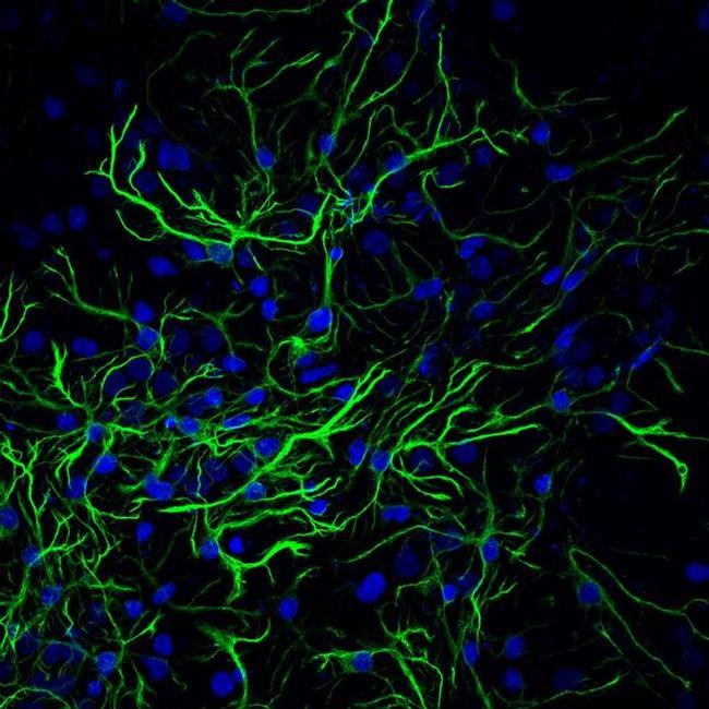 GFAP Antibody in Immunocytochemistry (ICC/IF)