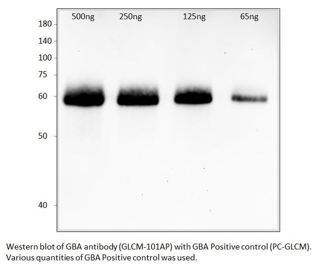 GBA Antibody in Western Blot (WB)