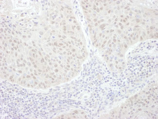 GLI3 Antibody in Immunohistochemistry (IHC)