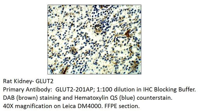 Glucose Transporter GLUT2 Antibody in Immunohistochemistry (IHC)