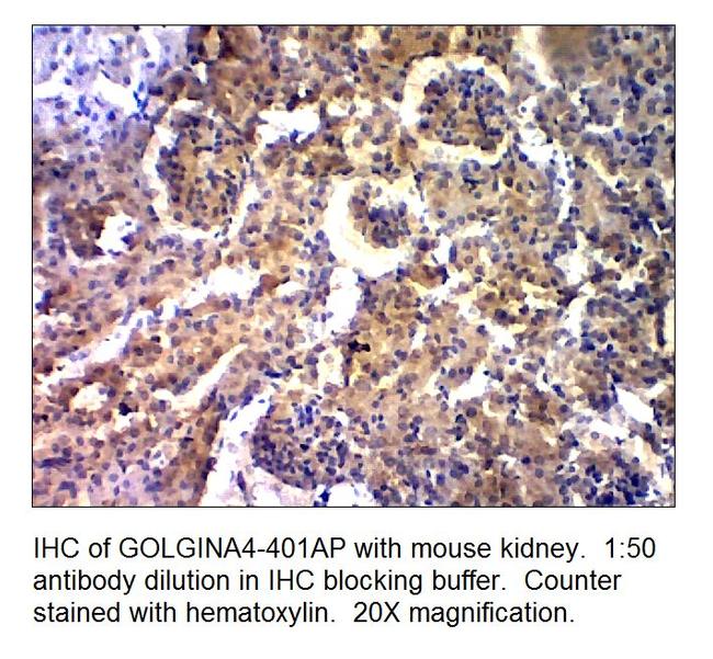 Golgin A4 Antibody in Immunohistochemistry (IHC)