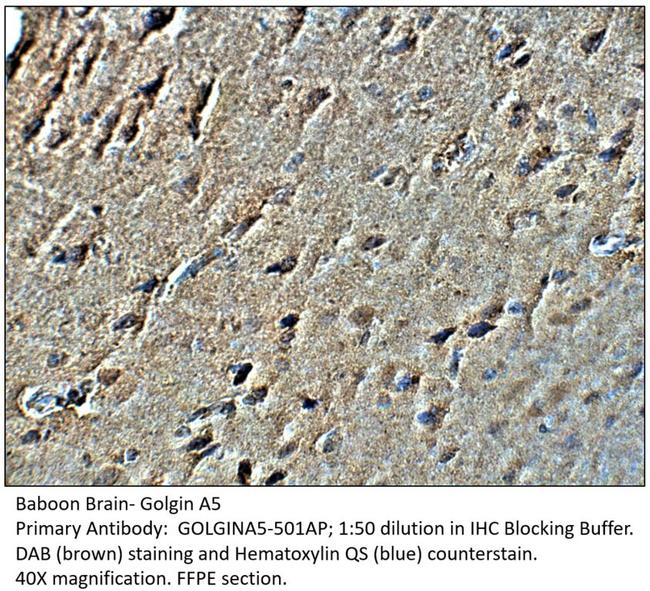 Golgin A5 Antibody in Immunohistochemistry (IHC)