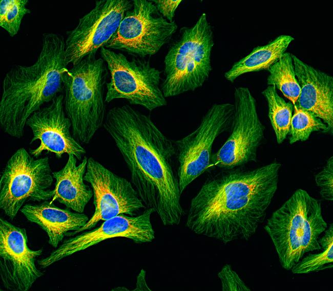 Rat IgG (H+L) Highly Cross-Adsorbed Secondary Antibody in Immunocytochemistry (ICC/IF)