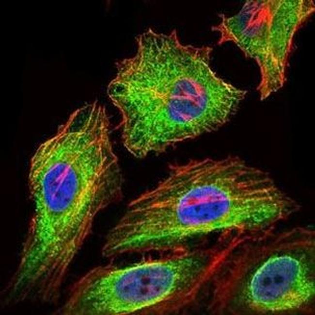 Glypican 3 Antibody in Immunocytochemistry (ICC/IF)