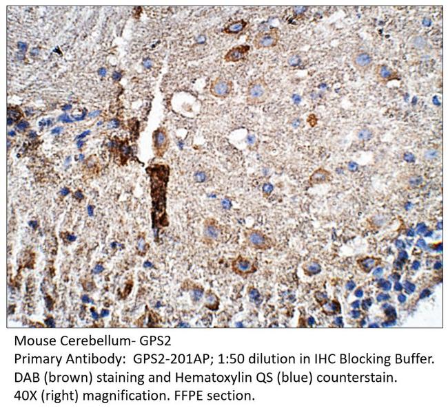 GPS2 Antibody in Immunohistochemistry (IHC)