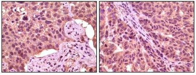 GSK3 alpha Antibody in Immunohistochemistry (Paraffin) (IHC (P))