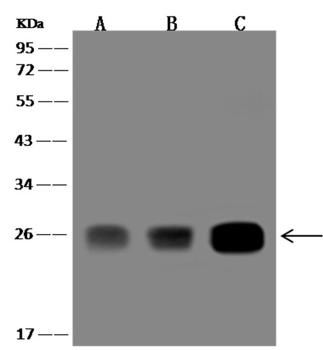 GSTZ1 Antibody in Western Blot (WB)