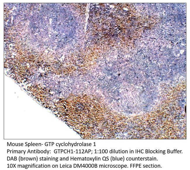 GTP cyclohydrolase 1 Antibody in Immunohistochemistry (IHC)