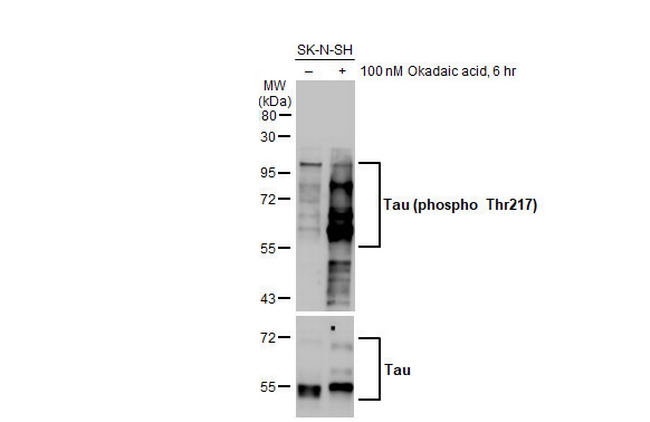 Phospho-Tau (Thr217) Antibody in Western Blot (WB)