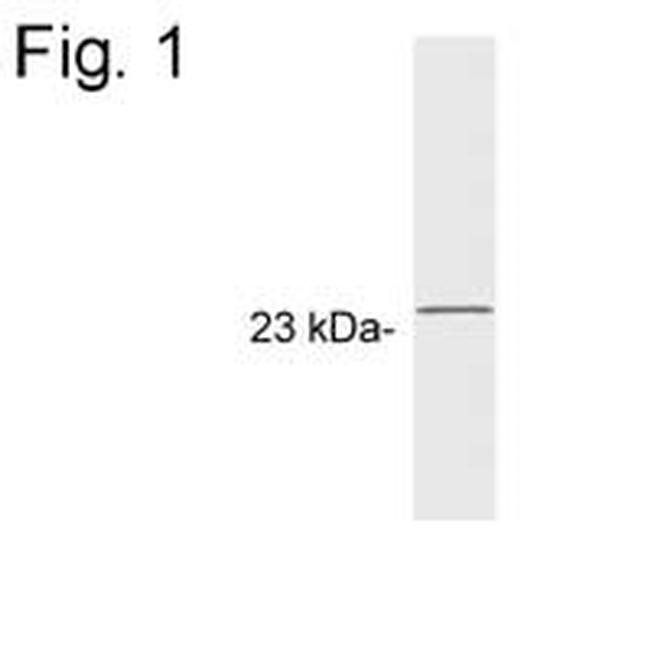 GCAP1 Antibody in Western Blot (WB)