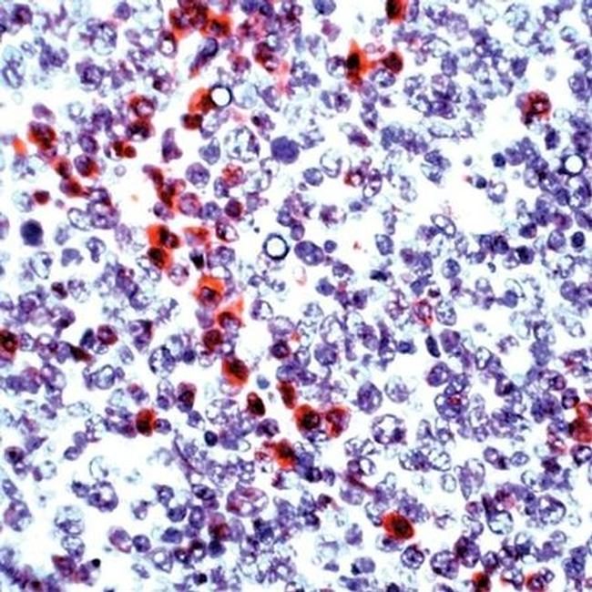 Granzyme B Antibody in Immunohistochemistry (Paraffin) (IHC (P))