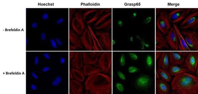 GRASP65 Antibody in Immunocytochemistry (ICC/IF)