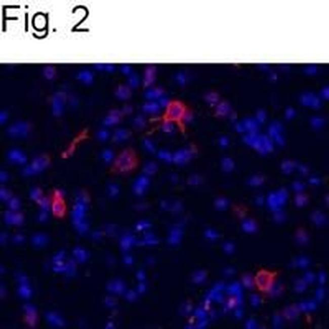 mGluR1 Antibody in Immunocytochemistry (ICC/IF)