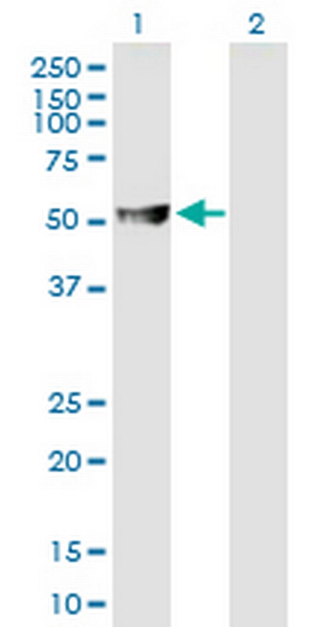 ABAT Antibody in Western Blot (WB)