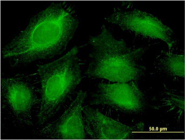 ABCF1 Antibody in Immunocytochemistry (ICC/IF)